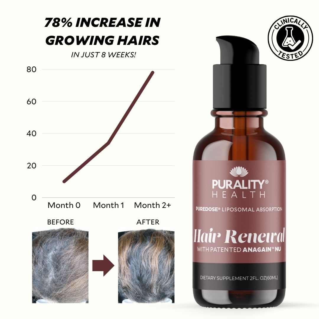 Hair Regrowth Offer – Clinically Proven & High-Converting